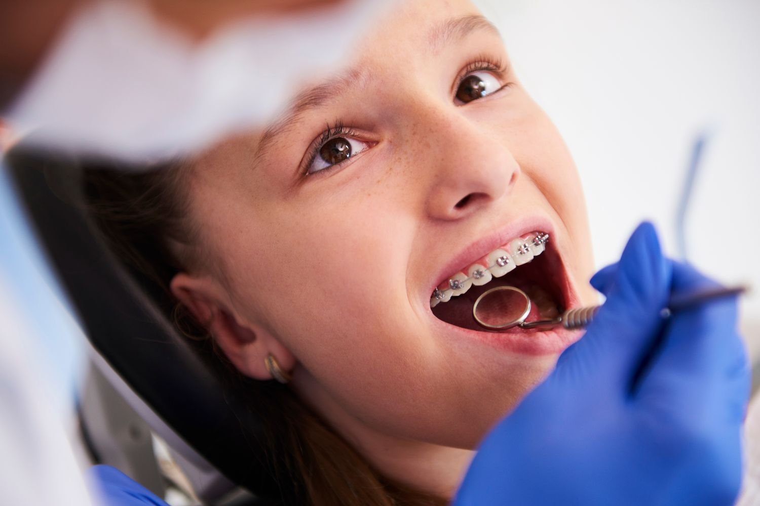 Which Orthodontic Treatment Is Right for You? Top Choices for Straighter Smiles in Hoover