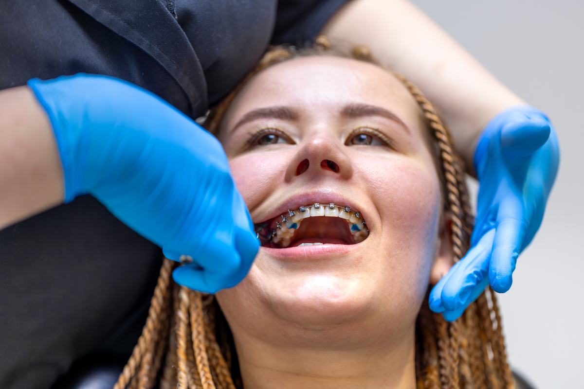 From Braces to Clear Aligners: Exploring Today’s Best Orthodontic Treatments