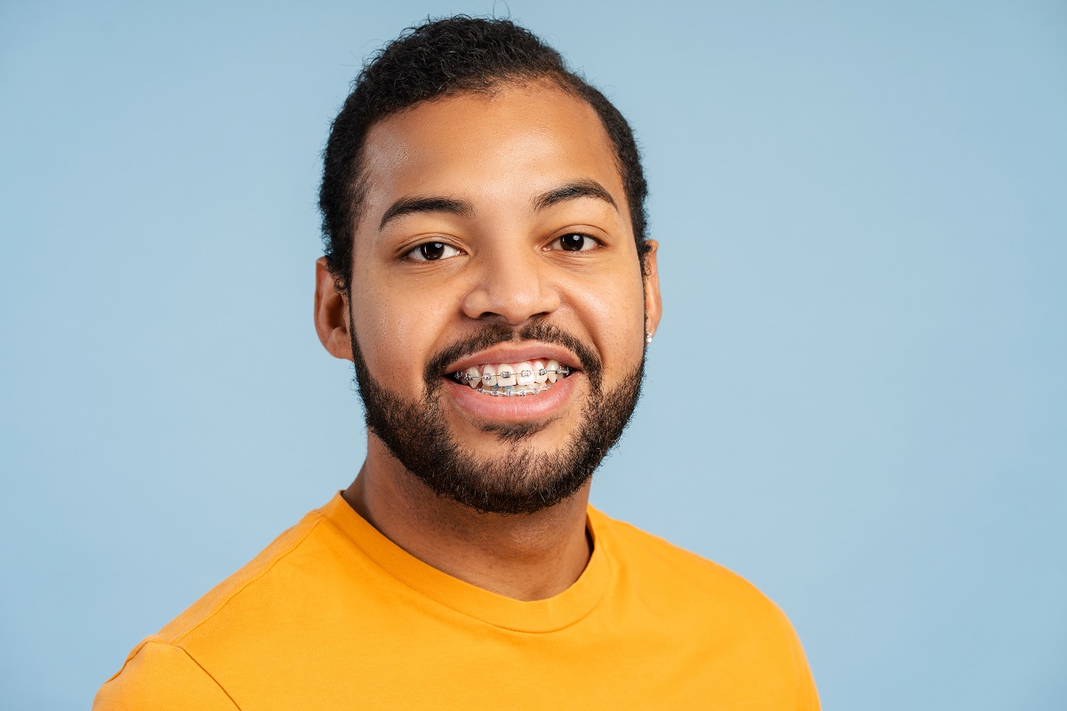 Think You’re Too Old for Braces? Read This First