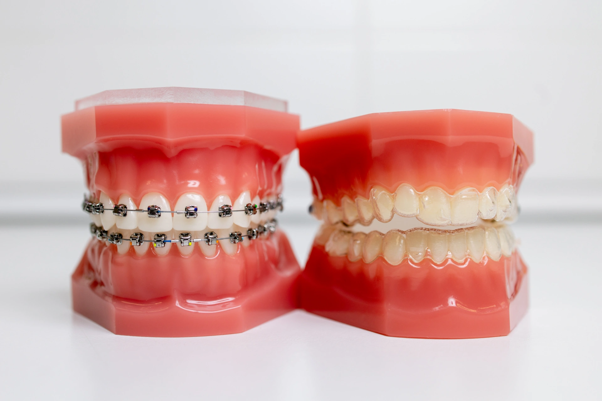 img-orthodontics-home-BROCKS-GAP-DENTISTRY